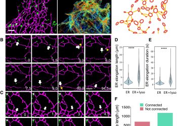 The structure and global distribution of the endoplasmic reticulum network are actively regulated by lysosomes
