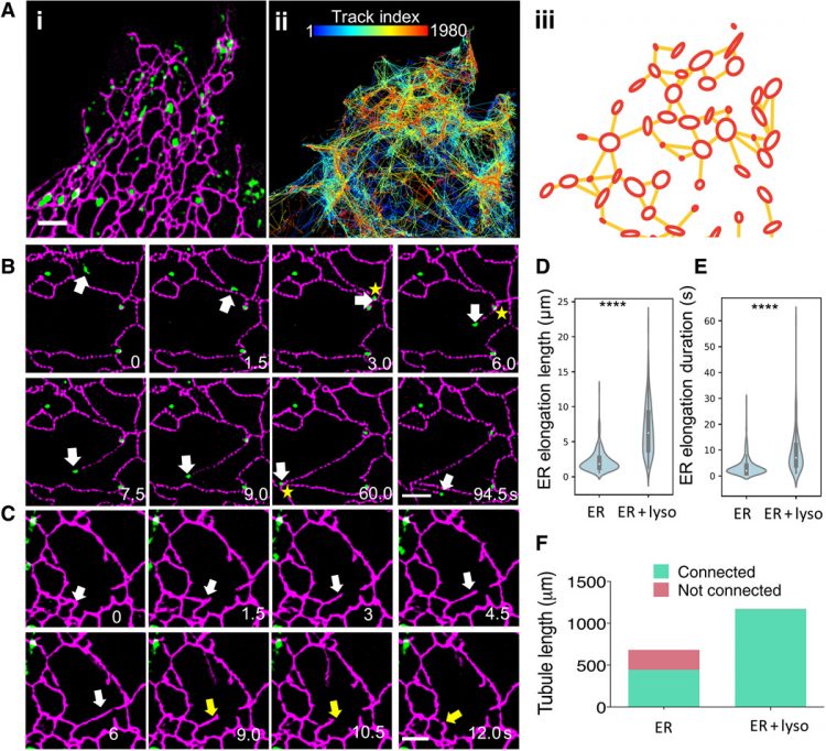 The structure and global distribution of the endoplasmic reticulum network are actively regulated by lysosomes