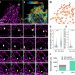 The structure and global distribution of the endoplasmic reticulum network are actively regulated by lysosomes