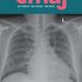 Hyoscine butylbromide versus acetaminophen for nonspecific colicky abdominal pain in children: a randomized controlled trial