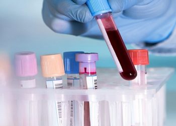Global Blood Management Devices Market 2020 – 2025 Research Study Provides Projections of COVID-19 Pandemic in its New Report