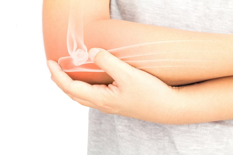 Meta-Analysis Assesses Failure Rate of Total Elbow Arthroplasty in Rheumatoid Arthritis