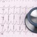 American Heart Association, Nov. 13-17 – Consumer Health News