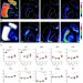 Mass spectrometry imaging identifies abnormally elevated brain l-DOPA levels and extrastriatal monoaminergic dysregulation in l-DOPA–induced dyskinesia