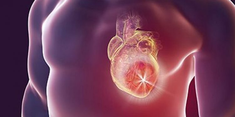 Predicted Heart Age Higher Among Cancer Survivors – Consumer Health News