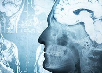 New Insights Into How COVID-19 Damages the Brain – Consumer Health News
