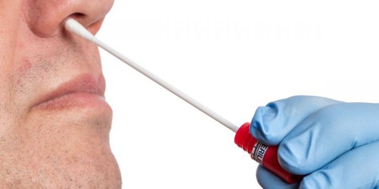 BinaxNOW Rapid Antigen Test Has Lower Sensitivity Than RT-PCR – Consumer Health News