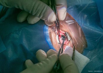 Evaluating scleral biomechanics to pinpoint root of accommodation