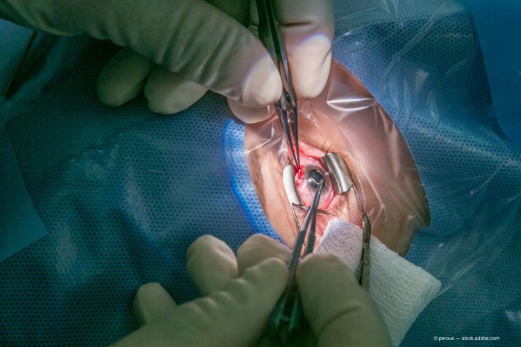 Evaluating scleral biomechanics to pinpoint root of accommodation