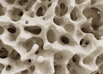 Risks After Denosumab Discontinuation Linked to Age and Prior Therapy