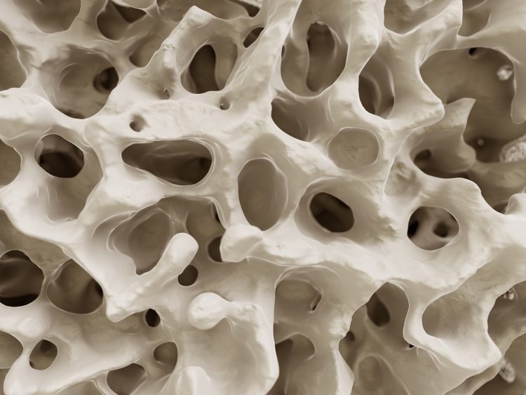 Risks After Denosumab Discontinuation Linked to Age and Prior Therapy