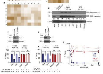 Mechanisms of stearoyl CoA desaturase inhibitor sensitivity and acquired resistance in cancer