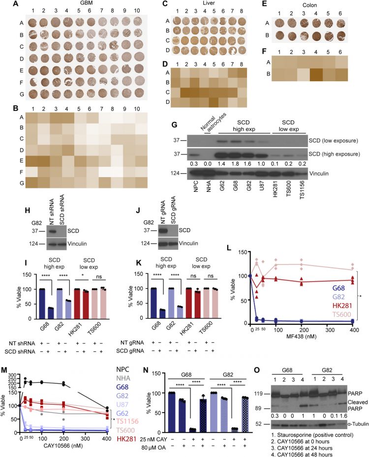 Mechanisms of stearoyl CoA desaturase inhibitor sensitivity and acquired resistance in cancer