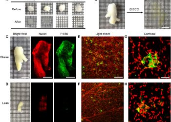 3D microscopy and deep learning reveal the heterogeneity of crown-like structure microenvironments in intact adipose tissue