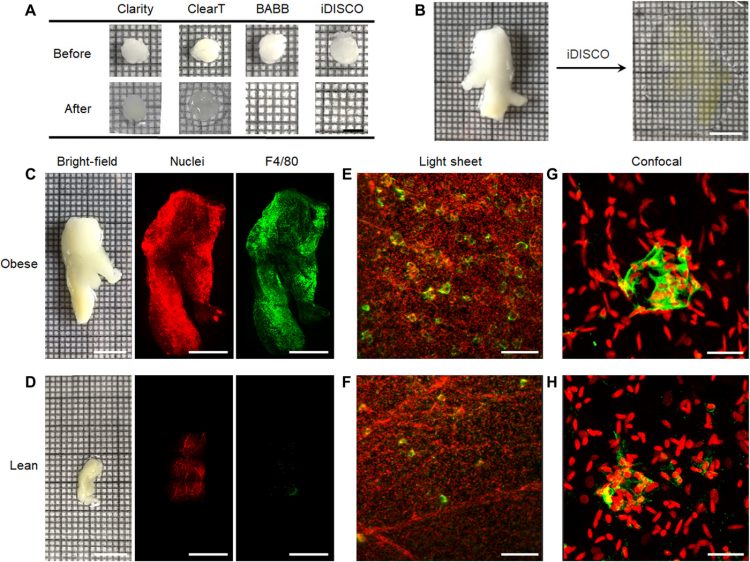 3D microscopy and deep learning reveal the heterogeneity of crown-like structure microenvironments in intact adipose tissue