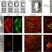 3D microscopy and deep learning reveal the heterogeneity of crown-like structure microenvironments in intact adipose tissue