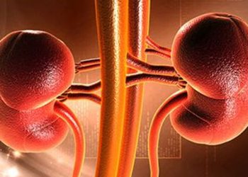 Transplant Beneficial for Kidney Failure in Sickle Cell – Consumer Health News