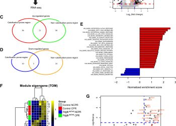 Microglia control small vessel calcification via TREM2