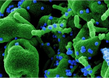 Immune profiling shows differences in COVID-19 and influenza pathologic pathways