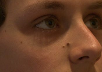 COVID-19 causes Dry Eye Disease: Here’s why