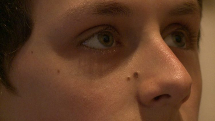 COVID-19 causes Dry Eye Disease: Here’s why