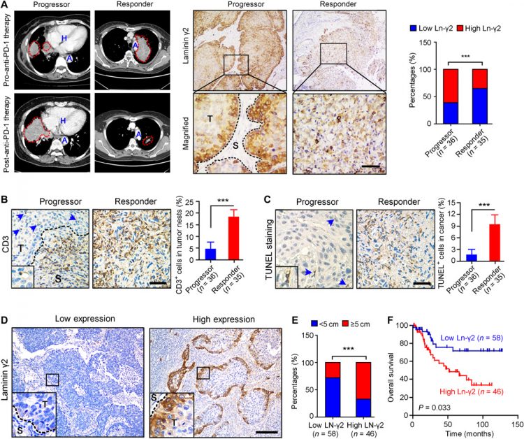 Laminin γ2–mediating T cell exclusion attenuates response to anti–PD-1 therapy