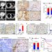 Laminin γ2–mediating T cell exclusion attenuates response to anti–PD-1 therapy