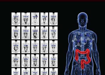 Obesity as a driver of international differences in COVID‐19 death rates – Gardiner – – Diabetes, Obesity and Metabolism