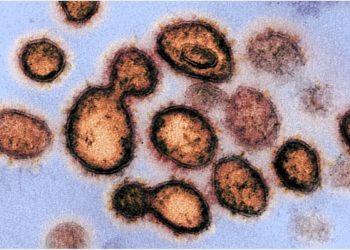 Is transposable element expression affected by SARS-CoV-2 infection?