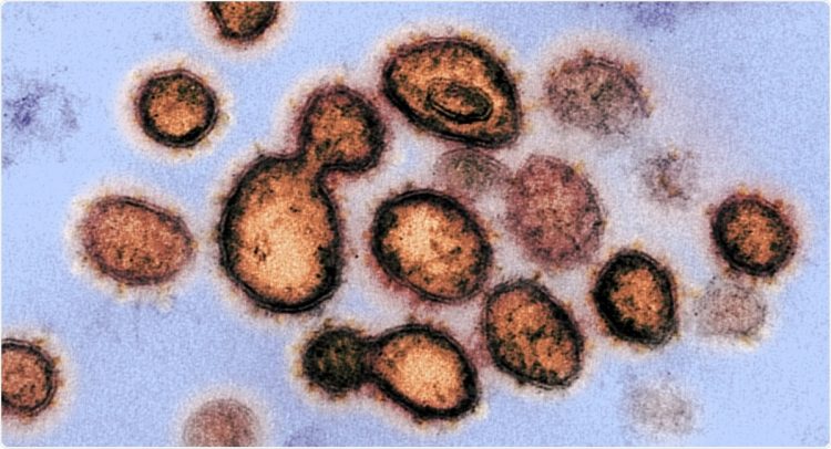 Is transposable element expression affected by SARS-CoV-2 infection?