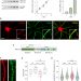 The elongation factor eEF1A2 controls translation and actin dynamics in dendritic spines