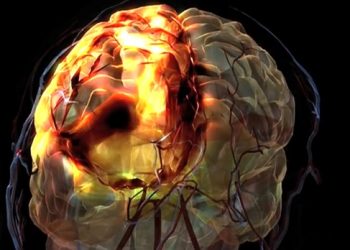 ‘Huge therapeutic potential’: University of Sask. researchers make progress on stroke treament